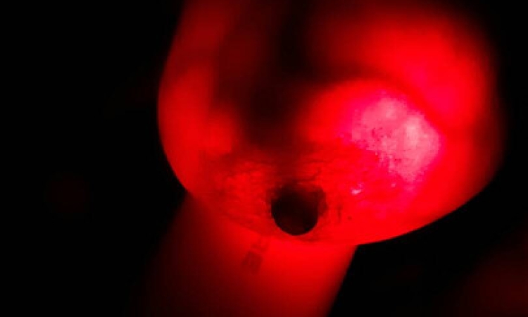 An Unprecedented High Prevalence Rate of Breast Cancer Detected in Berekum